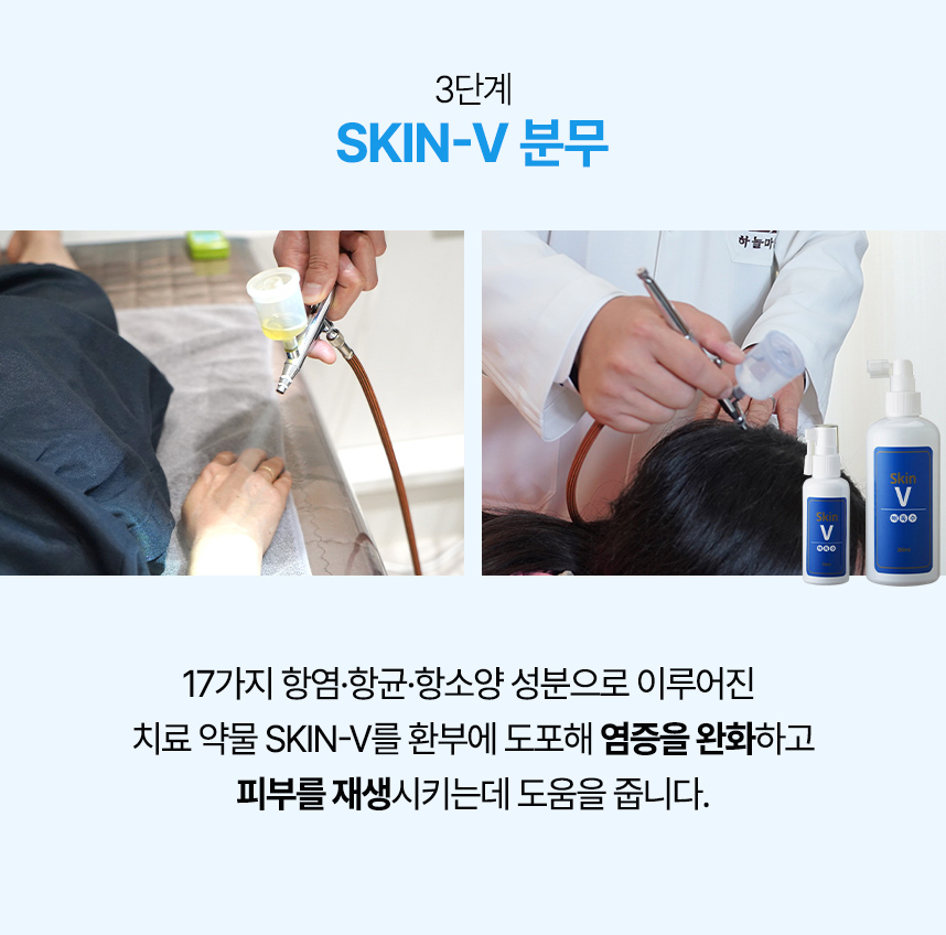 3단계 skin-v 분무, 4단계 수소수 스팀치료