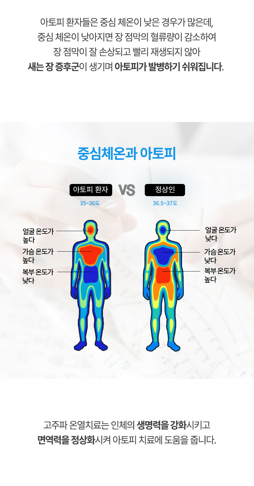 중심 체온이 낮아지면 장 점막의 혈류량이 감소하여 장 점막이 잘 손상되고 빨리 재생되지 않아 새는 장 증후군이 생기며 아토피가 발병하기 쉬워집니다. 고주파 온열치료는 인체의 생명력을 강화시키고 면역력을 정상화시켜 아토피 치료에 도움을 줍니다.