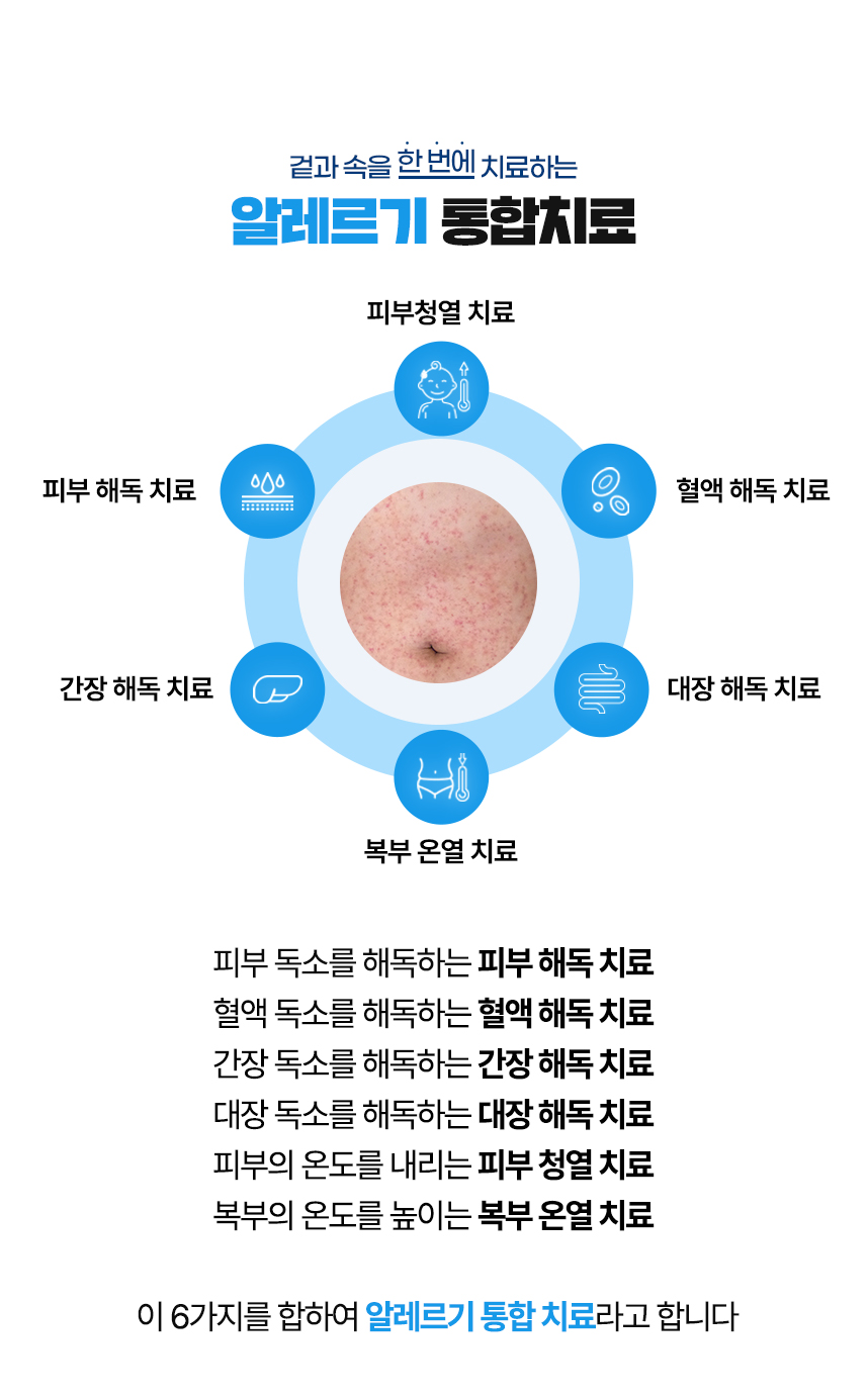 겉과 속을 함번에 치료하는 알레르기 통합치료 / 사중독소 장독소, 간독소, 혈액독소, 피부독소 사중독소의 4중 해독 치료 피부, 피부의 열을 내리는 피부 청열 치료, 복부의 온도를 높이는 복부 온열 치료