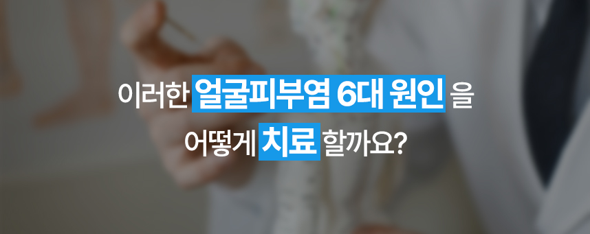 이러한 얼굴피부염 6대 원인을 어떻게 치료할까요?