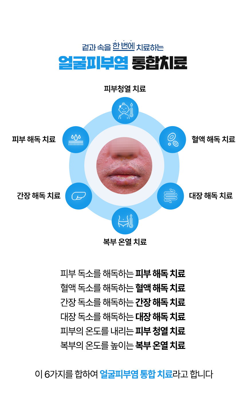 겉과 속을 함번에 치료하는 얼굴피부염 통합치료 / 사중독소 장독소, 간독소, 혈액독소, 피부독소 사중독소의 4중 해독 치료 피부, 피부의 열을 내리는 피부 청열 치료, 복부의 온도를 높이는 복부 온열 치료