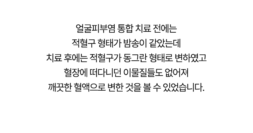 치료 전에는 적혈구 형태가 밤송이 같았는데 치료 후에는 동그란 형태로 변했고 혈장에 떠다니던 이물질들도 없어져 깨끗한 혈액으로 변한 것을 볼 수 있었습니다.