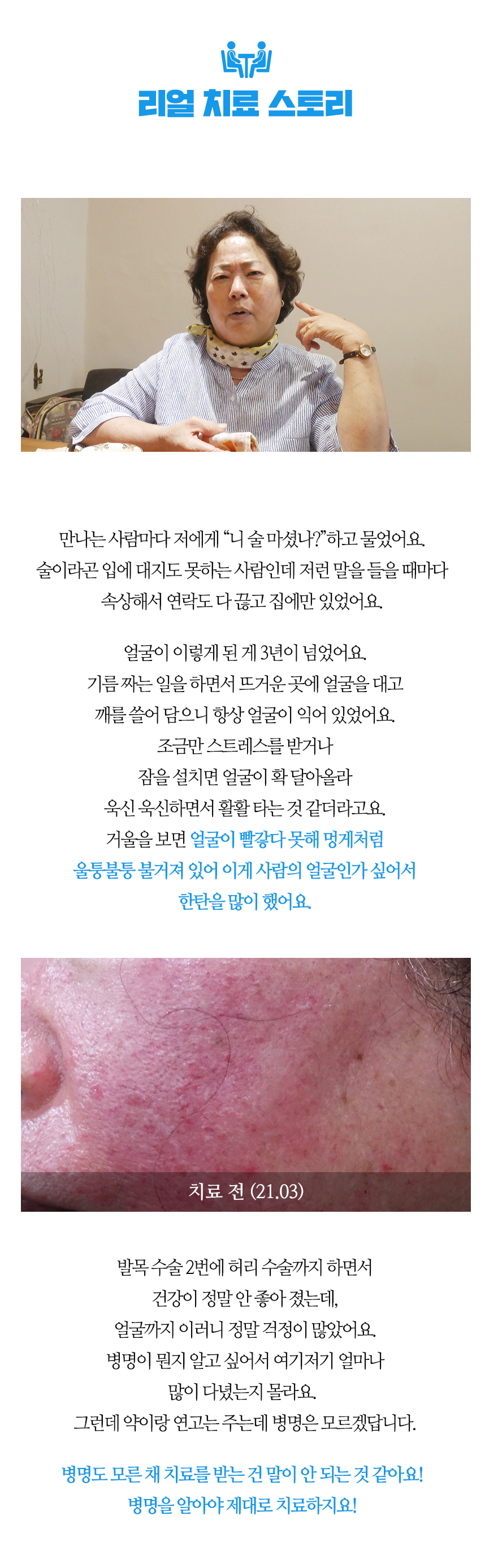 얼굴이 빨갛다못해 멍게처럼 울퉁불퉁 불거져 있어 이게 사람의 얼굴인가 싶어서 한탄을 많이 했어요.