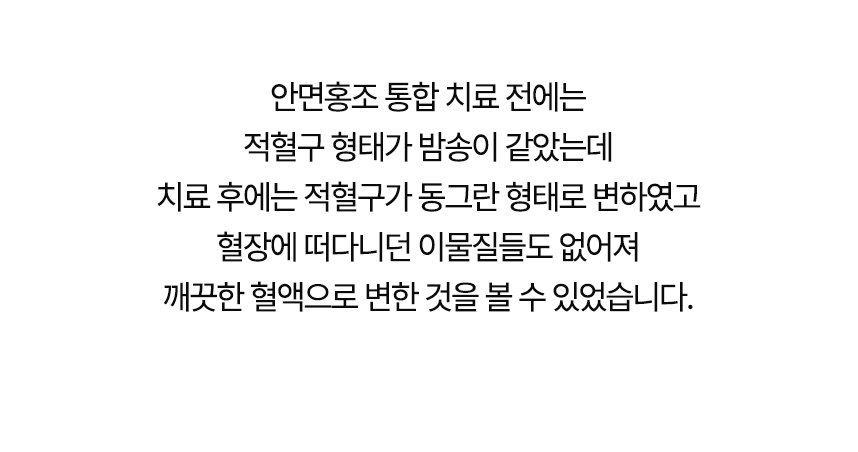 치료 전에는 적혈구 형태가 밤송이 같았는데 치료 후에는 동그란 형태로 변했고 혈장에 떠다니던 이물질들도 없어져 깨끗한 혈액으로 변한 것을 볼 수 있었습니다.