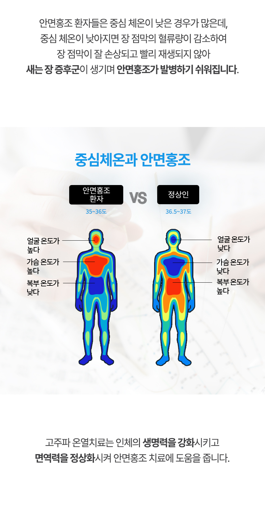 중심 체온이 낮아지면 장 점막의 혈류량이 감소하여 장 점막이 잘 손상되고 빨리 재생되지 않아 새는 장 증후군이 생기며 안면홍조가 발병하기 쉬워집니다. 고주파 온열치료는 인체의 생명력을 강화시키고 면역력을 정상화시켜 안면홍조 치료에 도움을 줍니다.