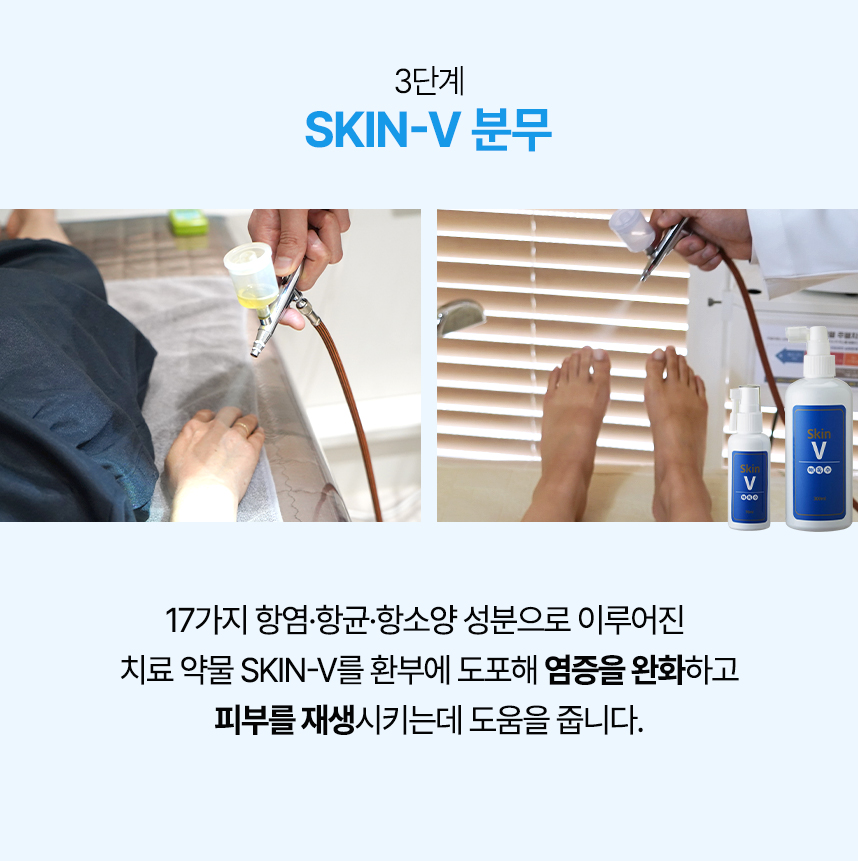 3단계 skin-v 분무