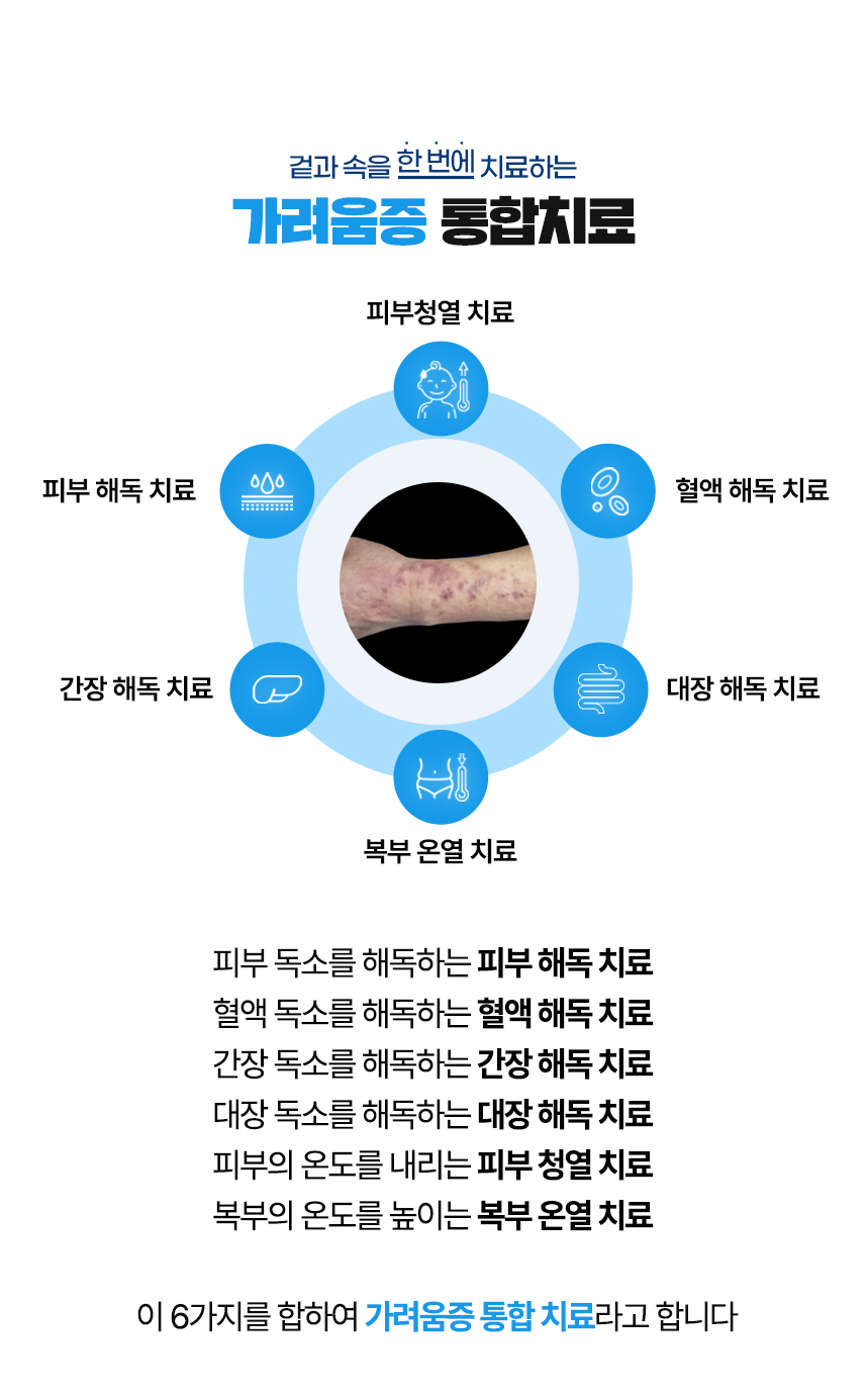 겉과 속을 함번에 치료하는 가려움증 통합치료 / 사중독소 장독소, 간독소, 혈액독소, 피부독소 사중독소의 4중 해독 치료 피부, 피부의 열을 내리는 피부 청열 치료, 복부의 온도를 높이는 복부 온열 치료