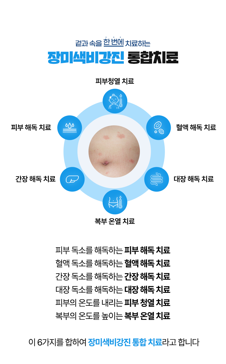 겉과 속을 함번에 치료하는 장미색비강진 통합치료 / 사중독소 장독소, 간독소, 혈액독소, 피부독소 사중독소의 4중 해독 치료 피부, 피부의 열을 내리는 피부 청열 치료, 복부의 온도를 높이는 복부 온열 치료