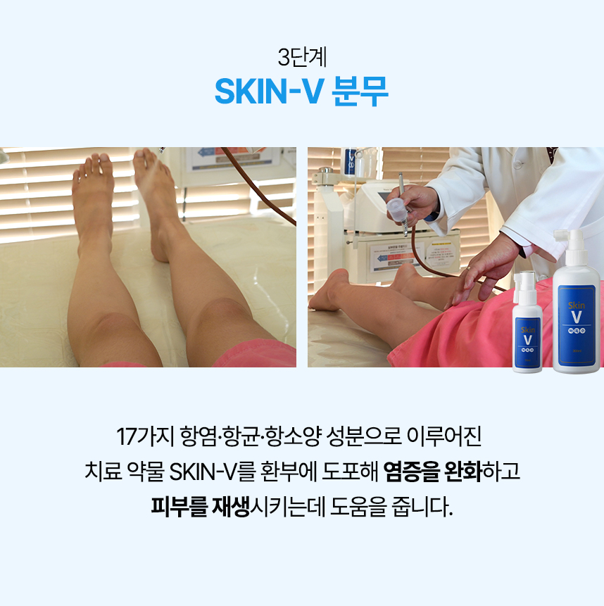 3단계 skin-v 분무