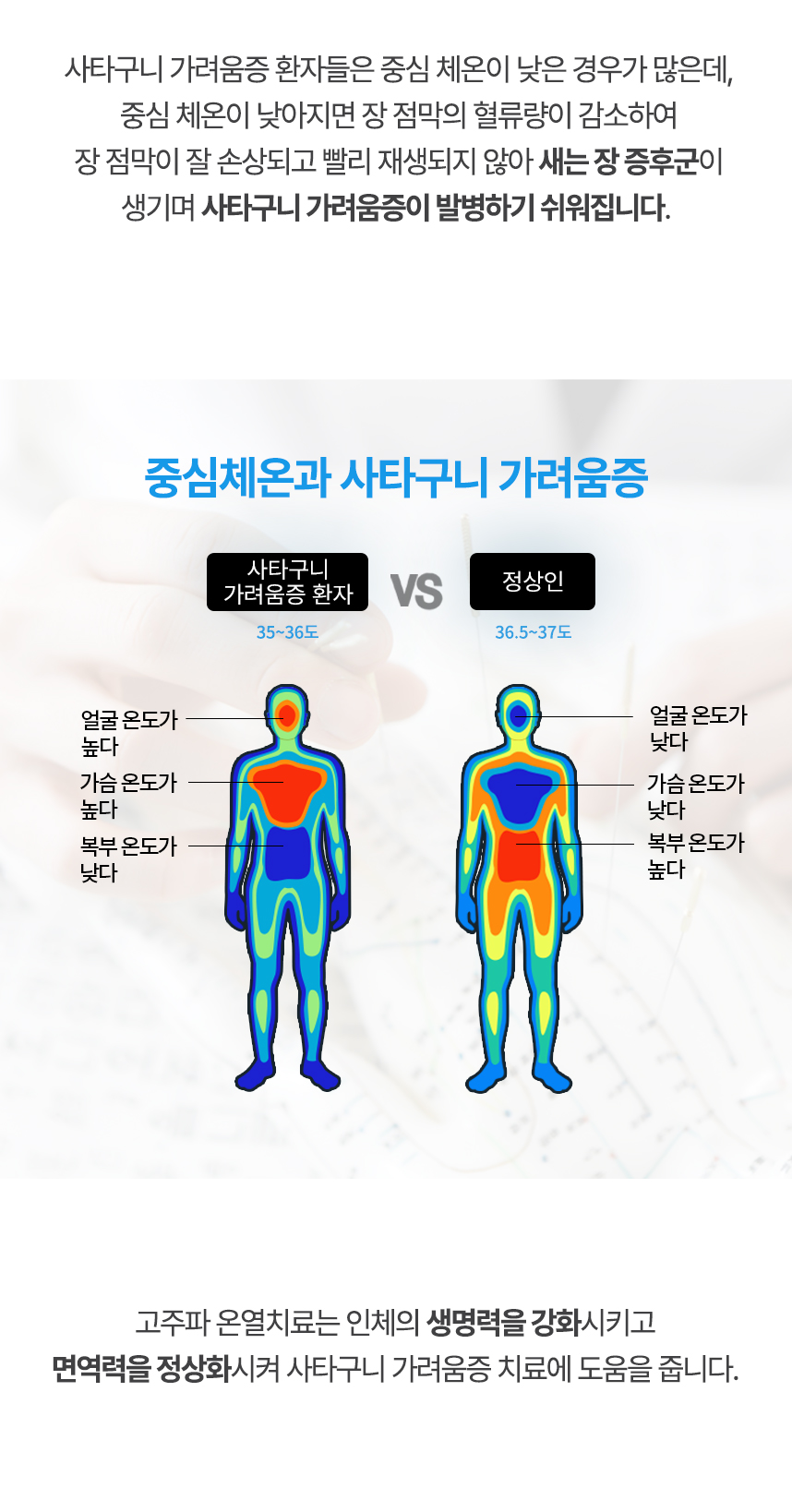 중심 체온이 낮아지면 장 점막의 혈류량이 감소하여 장 점막이 잘 손상되고 빨리 재생되지 않아 새는 장 증후군이 생기며 사타구니 가려움증이 발병하기 쉬워집니다. 고주파 온열치료는 인체의 생명력을 강화시키고 면역력을 정상화시켜 사타구니 가려움증 치료에 도움을 줍니다.