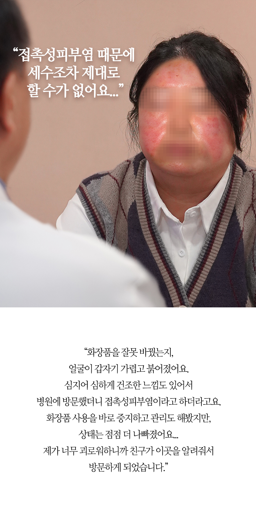 접촉성피부염 때문에 세수조차 제대로 할 수가 없어요...