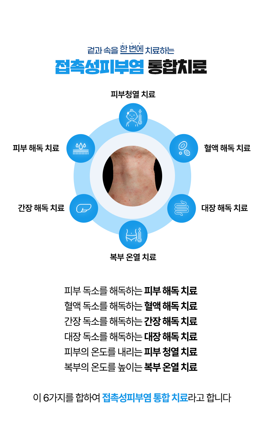 겉과 속을 함번에 치료하는 접촉성피부염 통합치료 / 사중독소 장독소, 간독소, 혈액독소, 피부독소 사중독소의 4중 해독 치료 피부, 피부의 열을 내리는 피부 청열 치료, 복부의 온도를 높이는 복부 온열 치료