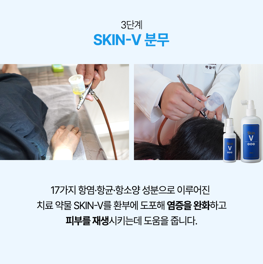 3단계 skin-v 분무