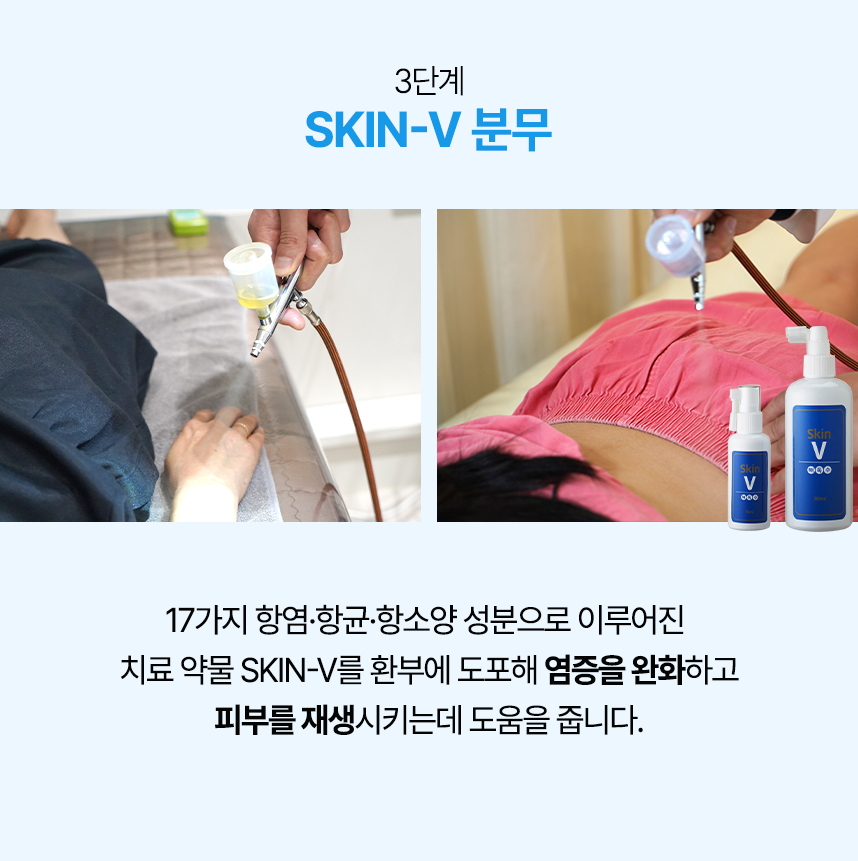 3단계 skin-v 분무, 4단계 수소수 스팀치료