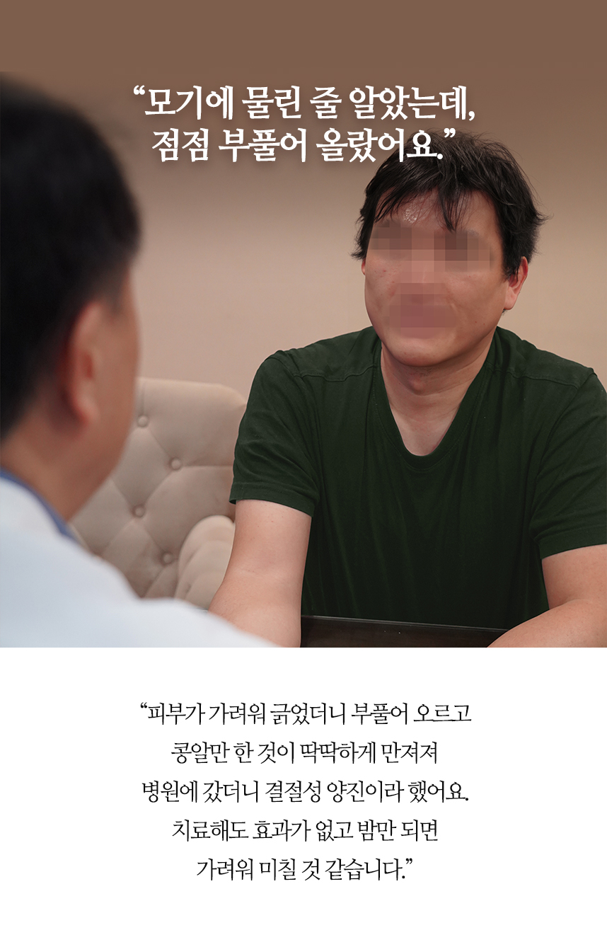 모기에 물린 줄 알았는데, 점점 부풀어올랐어요