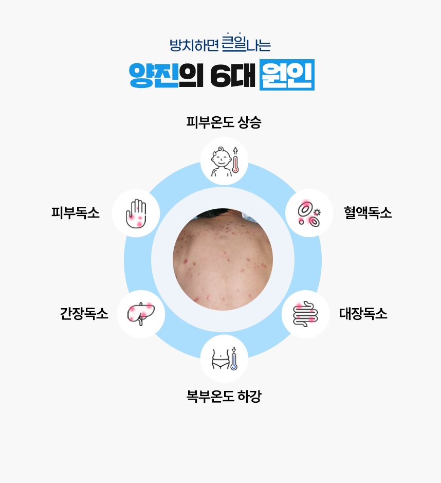 또한 양진 증상이 있는 피부 온도는 높게 상승되어 있고 복부 온도는 낮게 하강되어 있는 병리적인 특성이 있어 이 6가지를 양진이 발병하는 6대 원인으로 보고 있습니다.