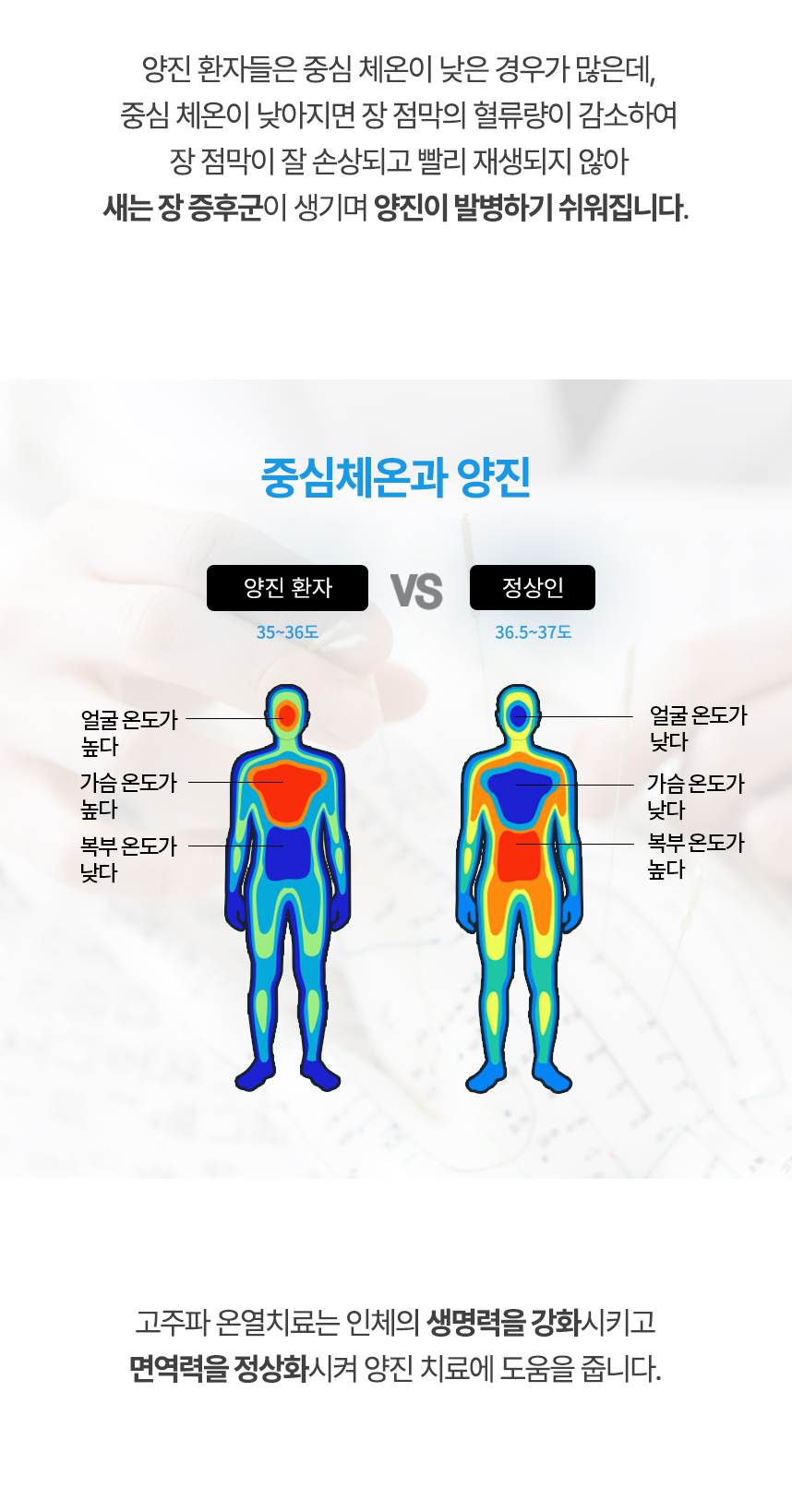 중심 체온이 낮아지면 장 점막의 혈류량이 감소하여 장 점막이 잘 손상되고 빨리 재생되지 않아 새는 장 증후군이 생기며 양진이 발병하기 쉬워집니다. 고주파 온열치료는 인체의 생명력을 강화시키고 면역력을 정상화시켜 양진 치료에 도움을 줍니다.