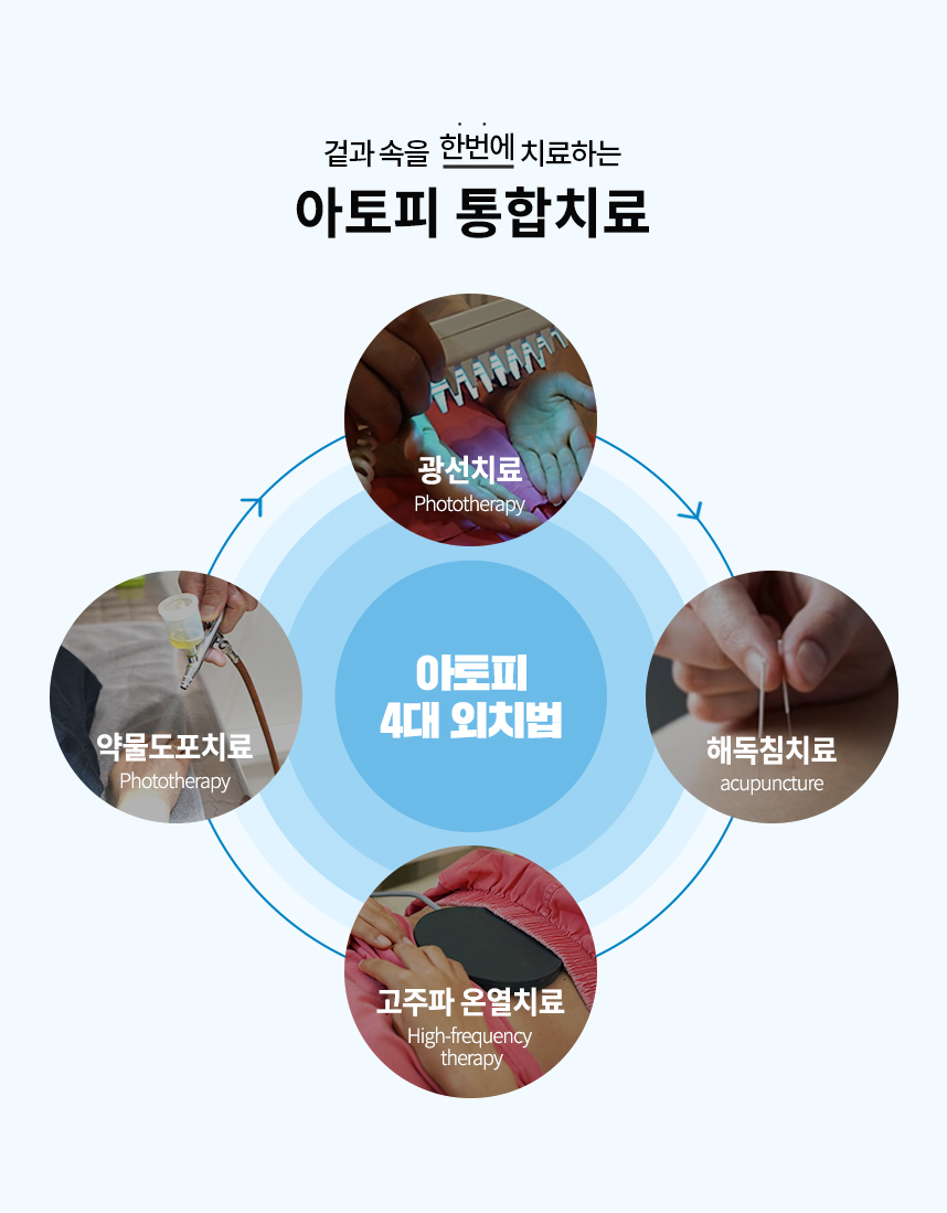 통합치료