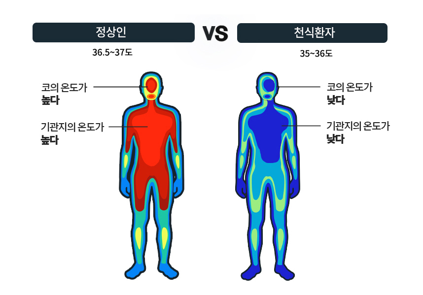 비염환자의 비강 온도 측정