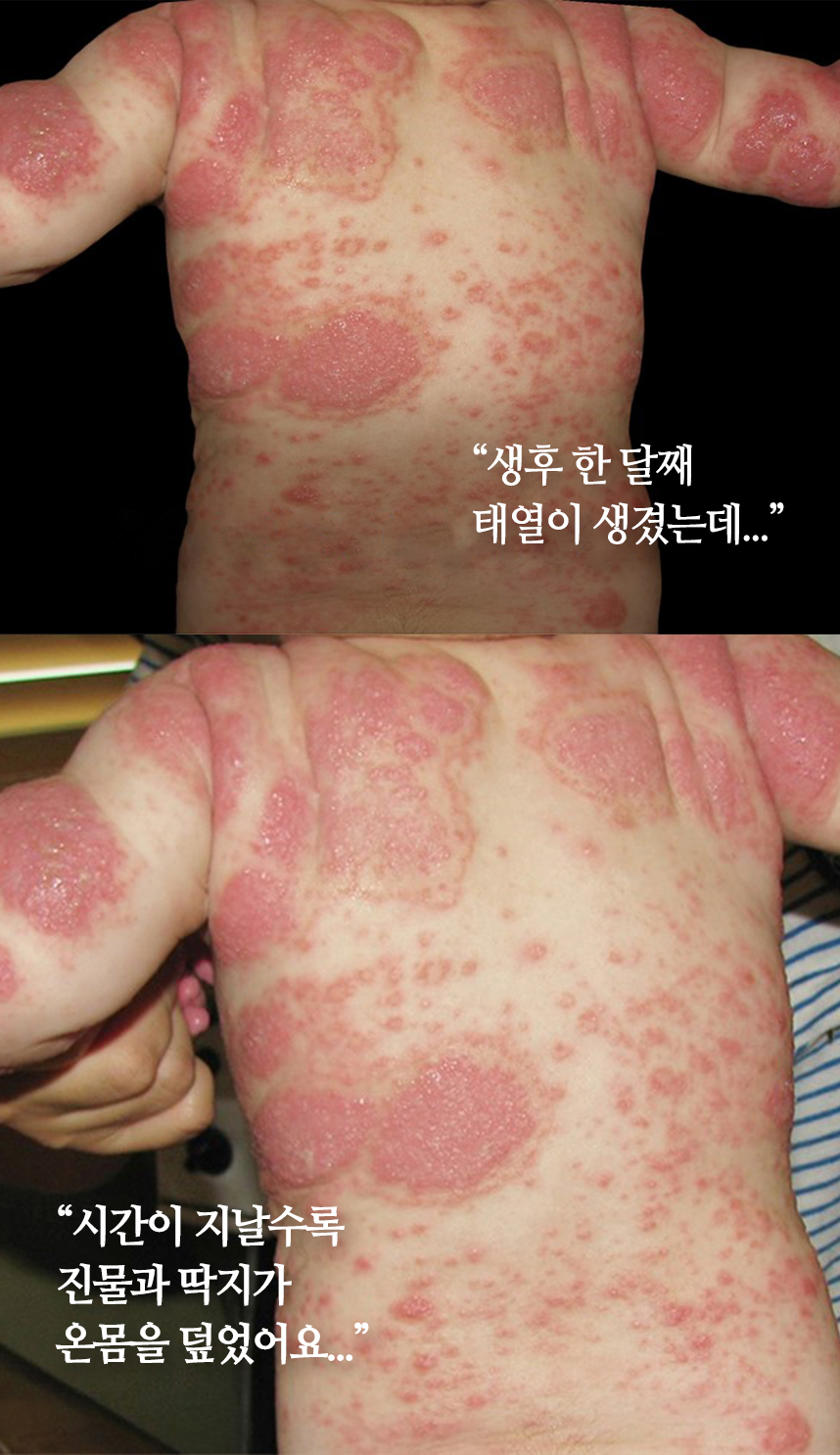 환자 스토리