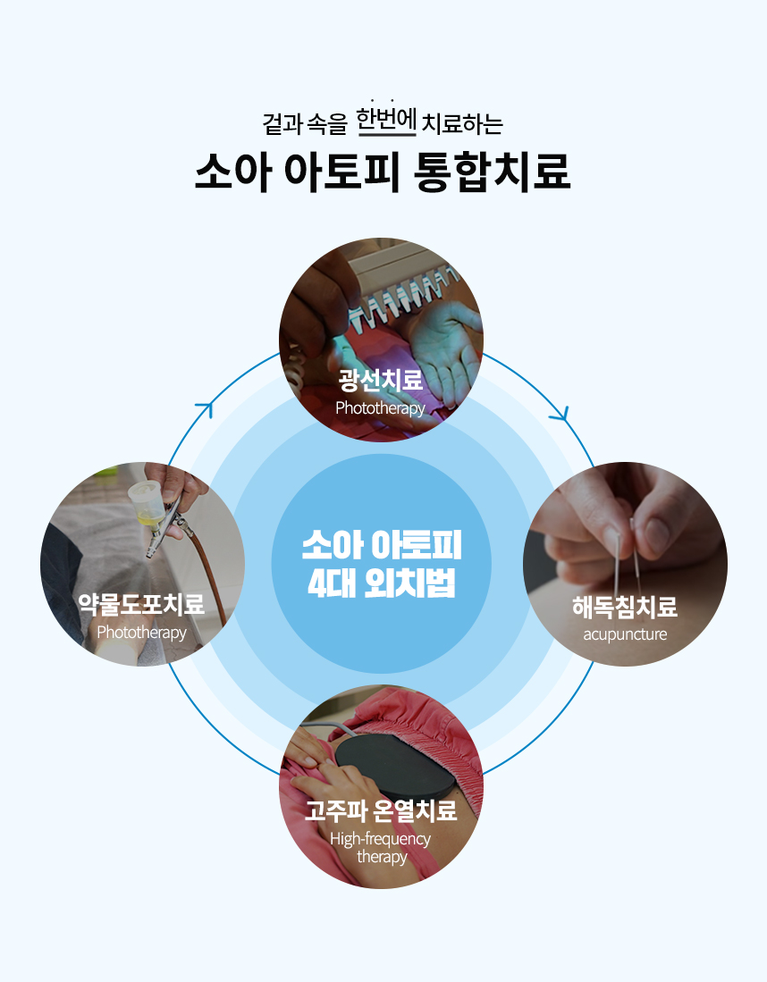 통합치료