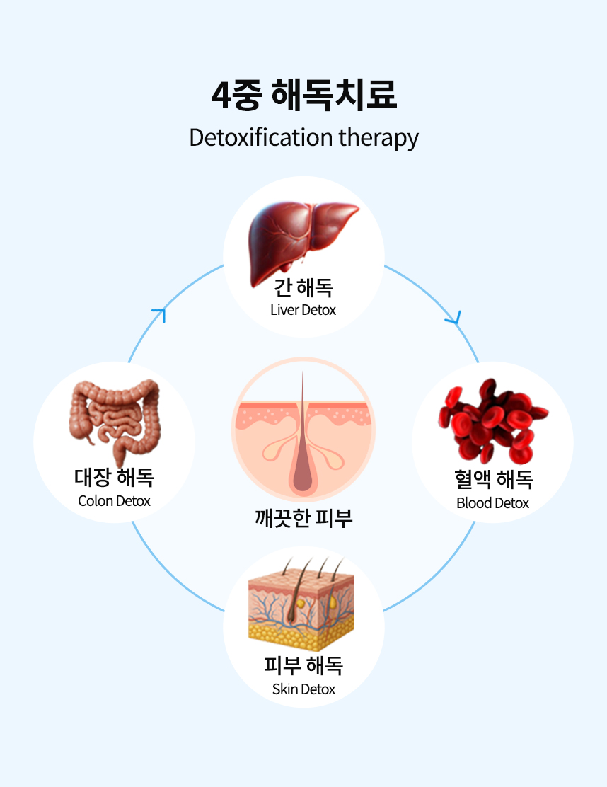 4중 해독 치료