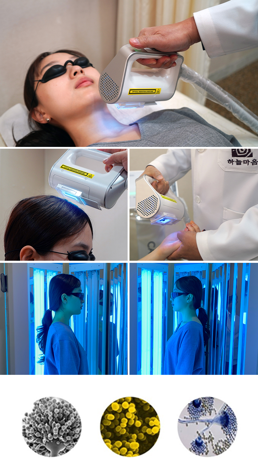 광선치료를 받는 환자