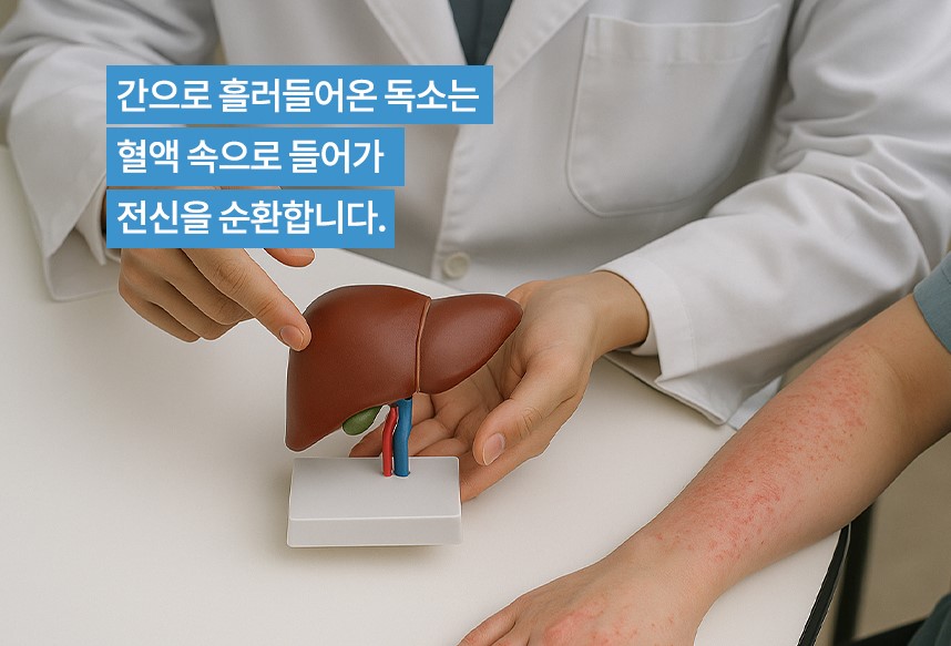 소아 아토피의 원리에 대해 설명하는 하늘마음한의원 한의사 