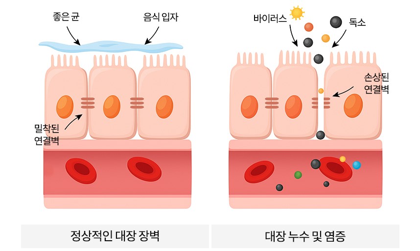 혈액 속 독소