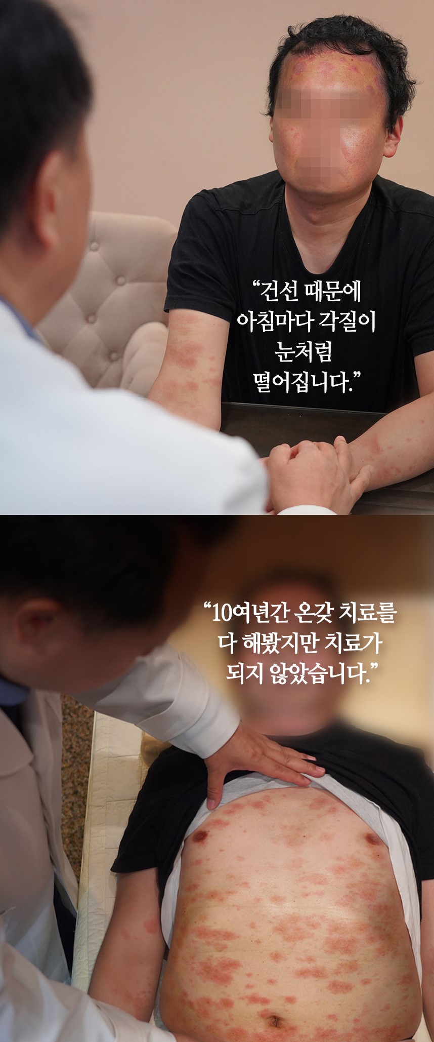 환자 스토리