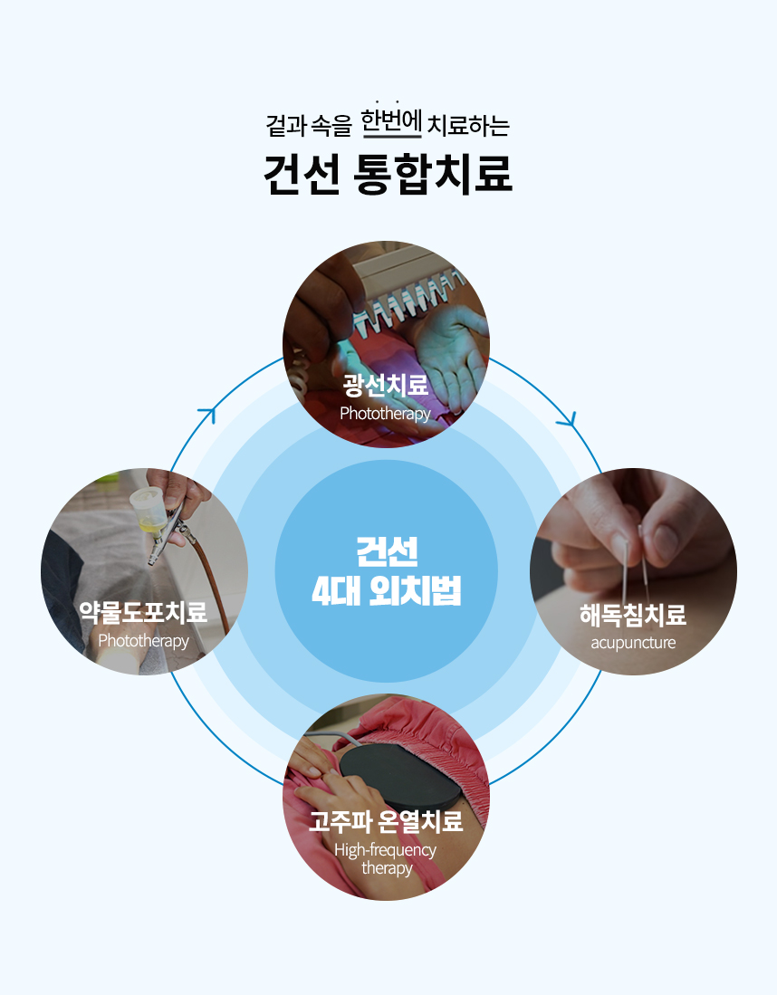 통합치료