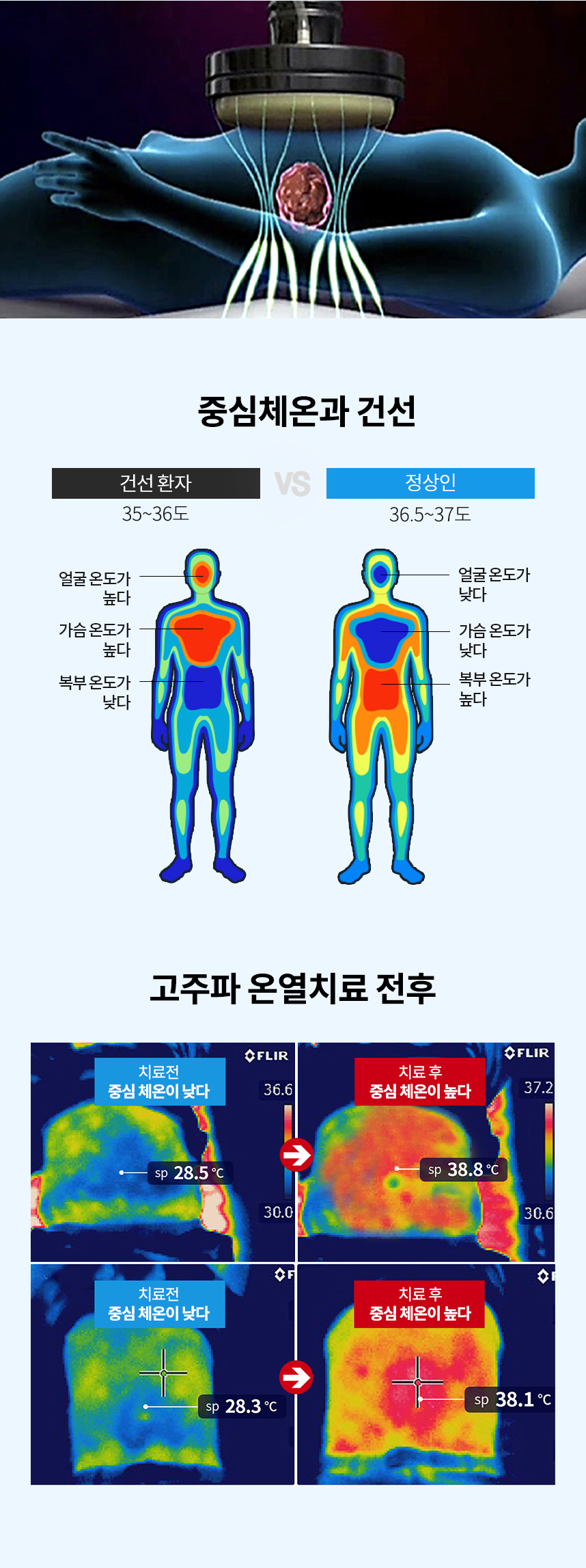 약물도포치료를 받는 건선환자