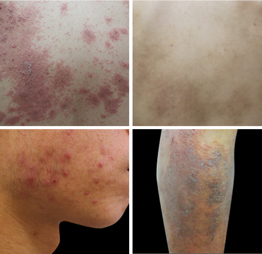 피부 가려움증의 원인 4가지 증상과 관리방법 6